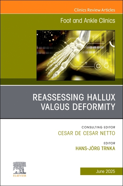Reassessing Hallux Valgus Deformity, an Issue of Foot and Ankle Clinics of North America: Volume 30-