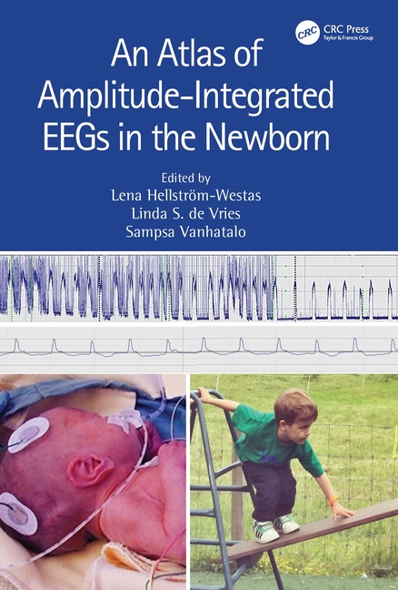Atlas of Amplitude-Integrated Eegs in the Newborn