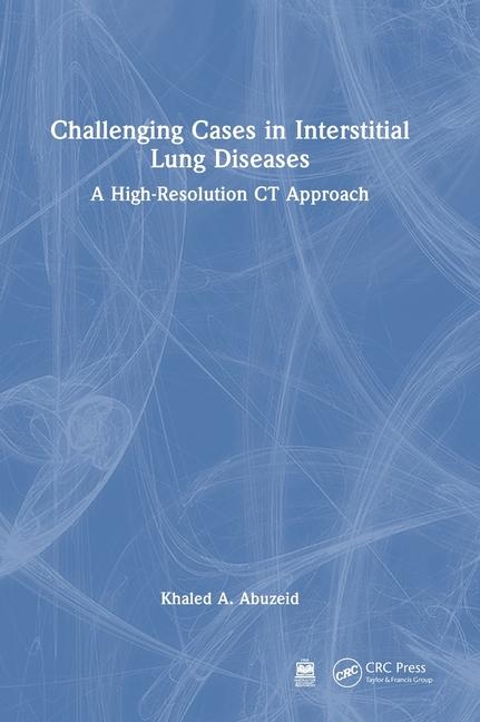 Challenging Cases in Interstitial Lung Diseases: A High-Resolution CT Approach