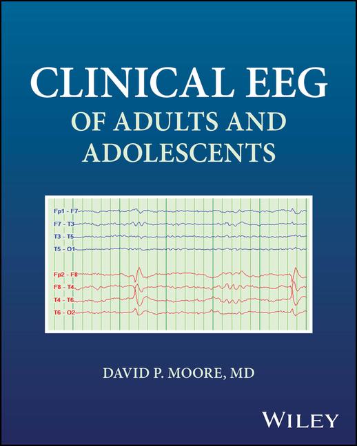 Clinical Eeg of Adults and Adolescents