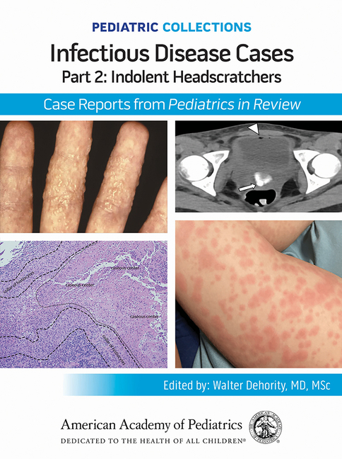 Pediatric Collections: Infectious Disease Cases: Part 2: Indolent Head Scratchers: Case Reports from