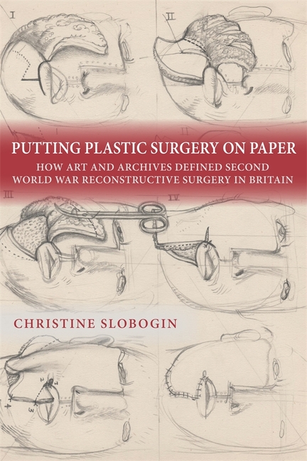 Putting Plastic Surgery on Paper: How Art and Archives Defined Second World War Reconstructive Surge