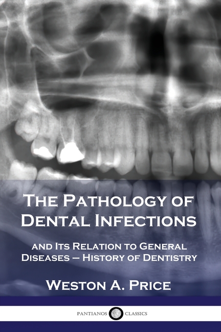 Pathology of Dental Infections: and Its Relation to General Diseases - History of Dentistry