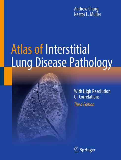 Atlas of Interstitial Lung Disease Pathology: With High Resolution CT Correlations (Third 2025)