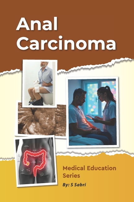 Anal Carcinoma