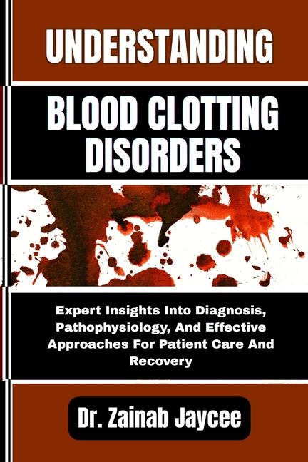 Understanding Blood Clotting Disorders: Expert Insights Into Diagnosis, Pathophysiology, And Effecti
