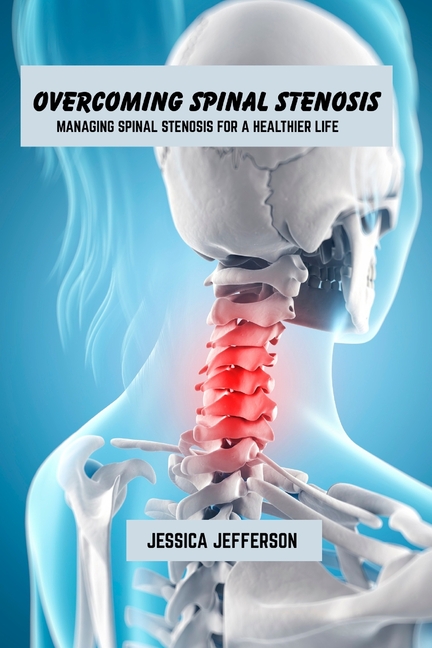 Overcoming spinal stenosis: Managing spinal stenosis for a healthier life