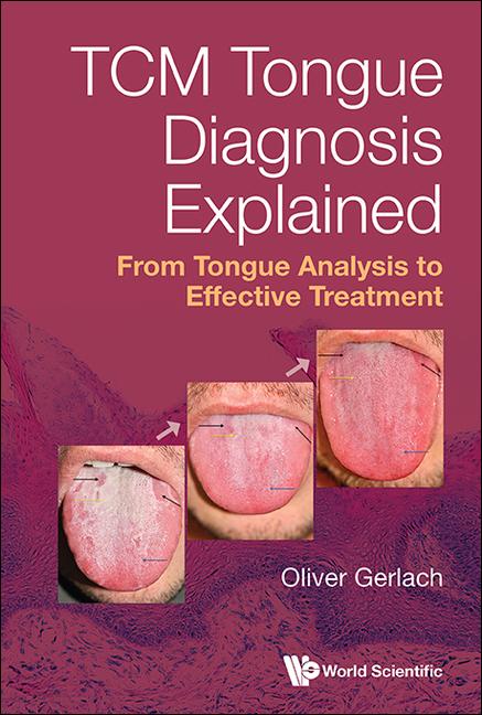 Tcm Tongue Diagnosis Explained